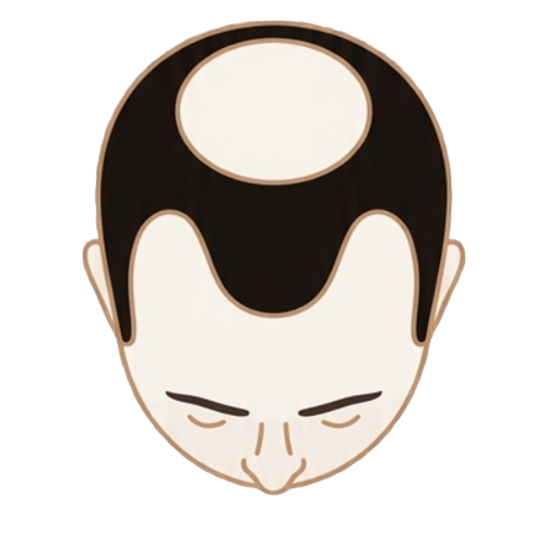 Nível 4