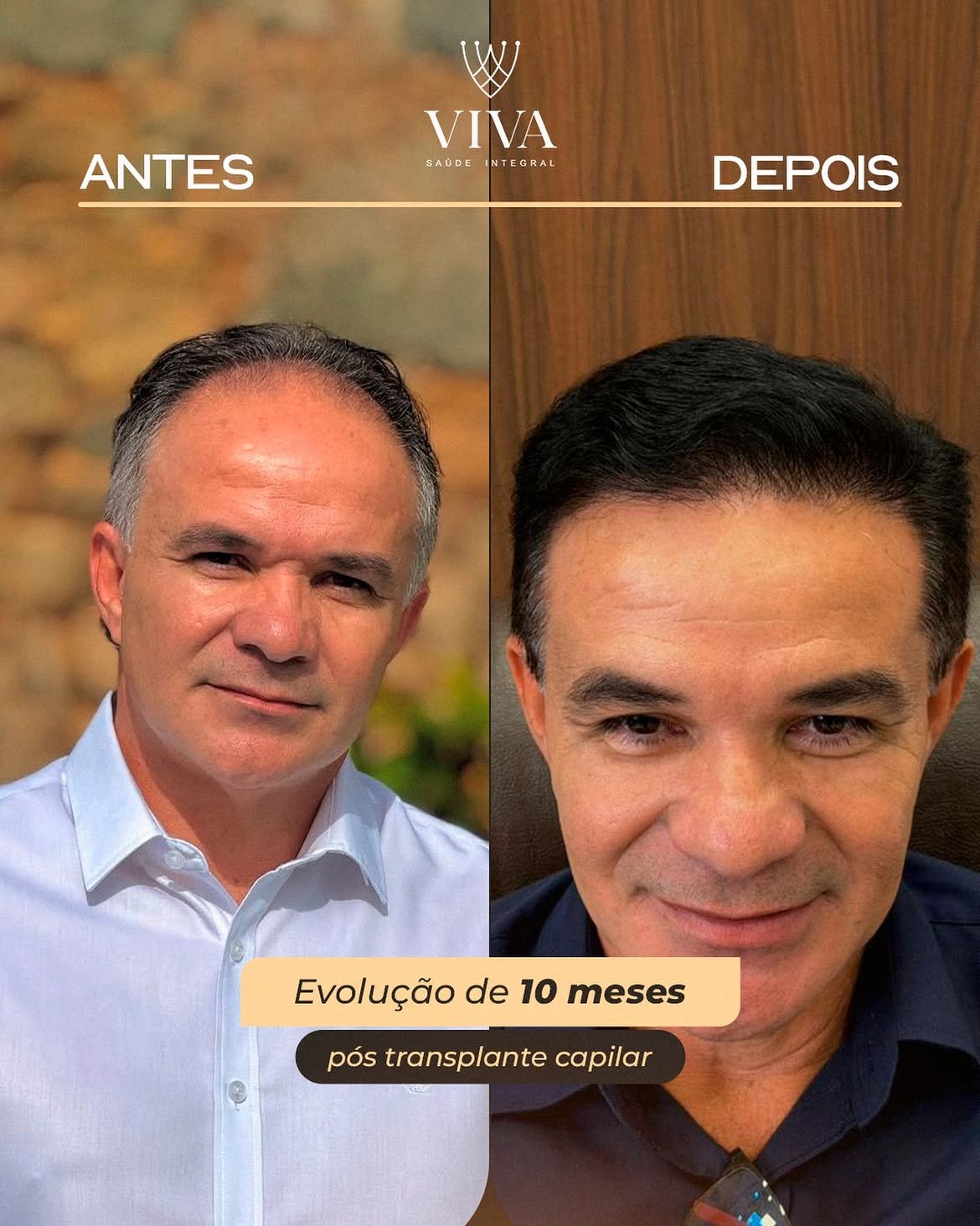 Resultado antes e depois
