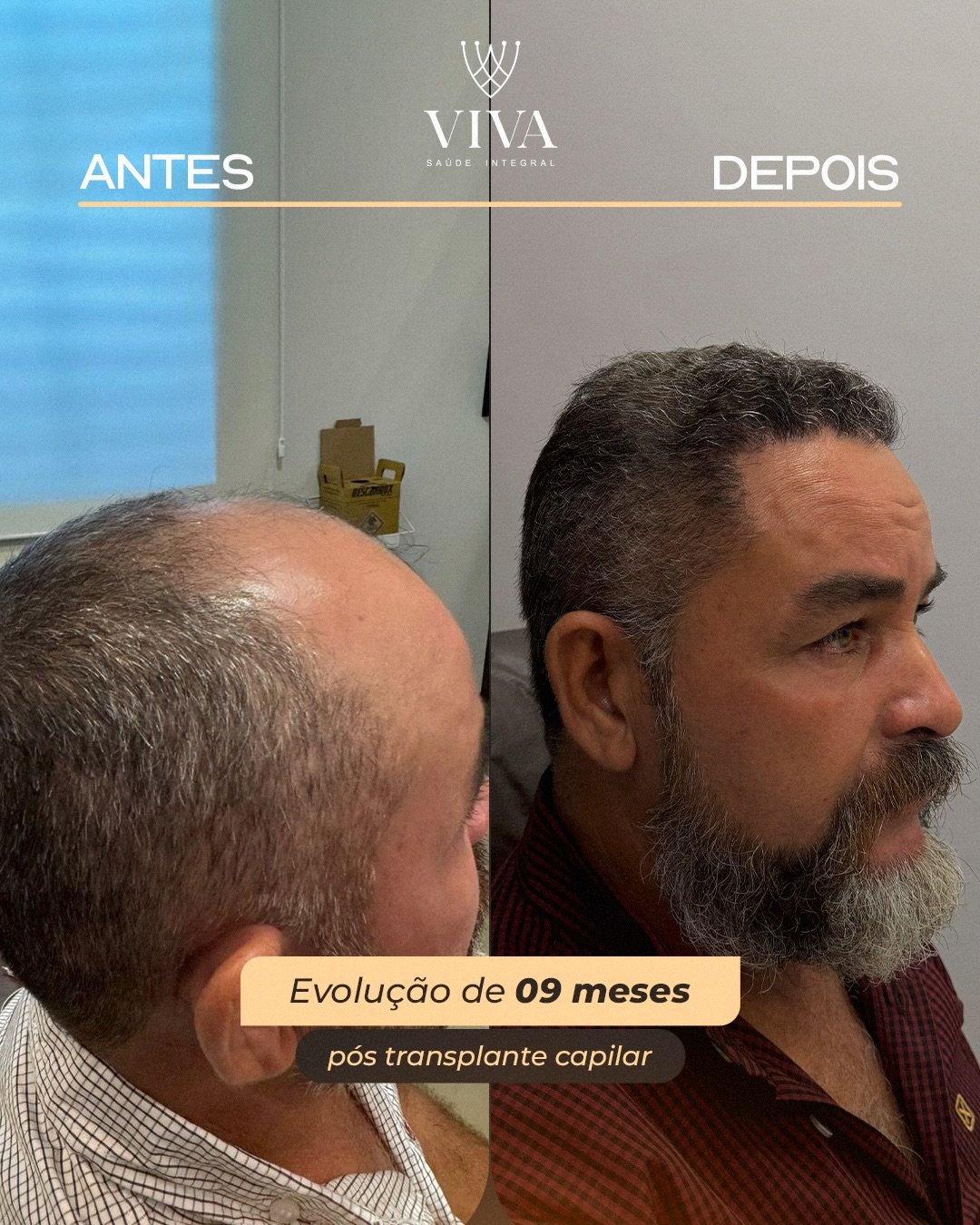 Resultado antes e depois