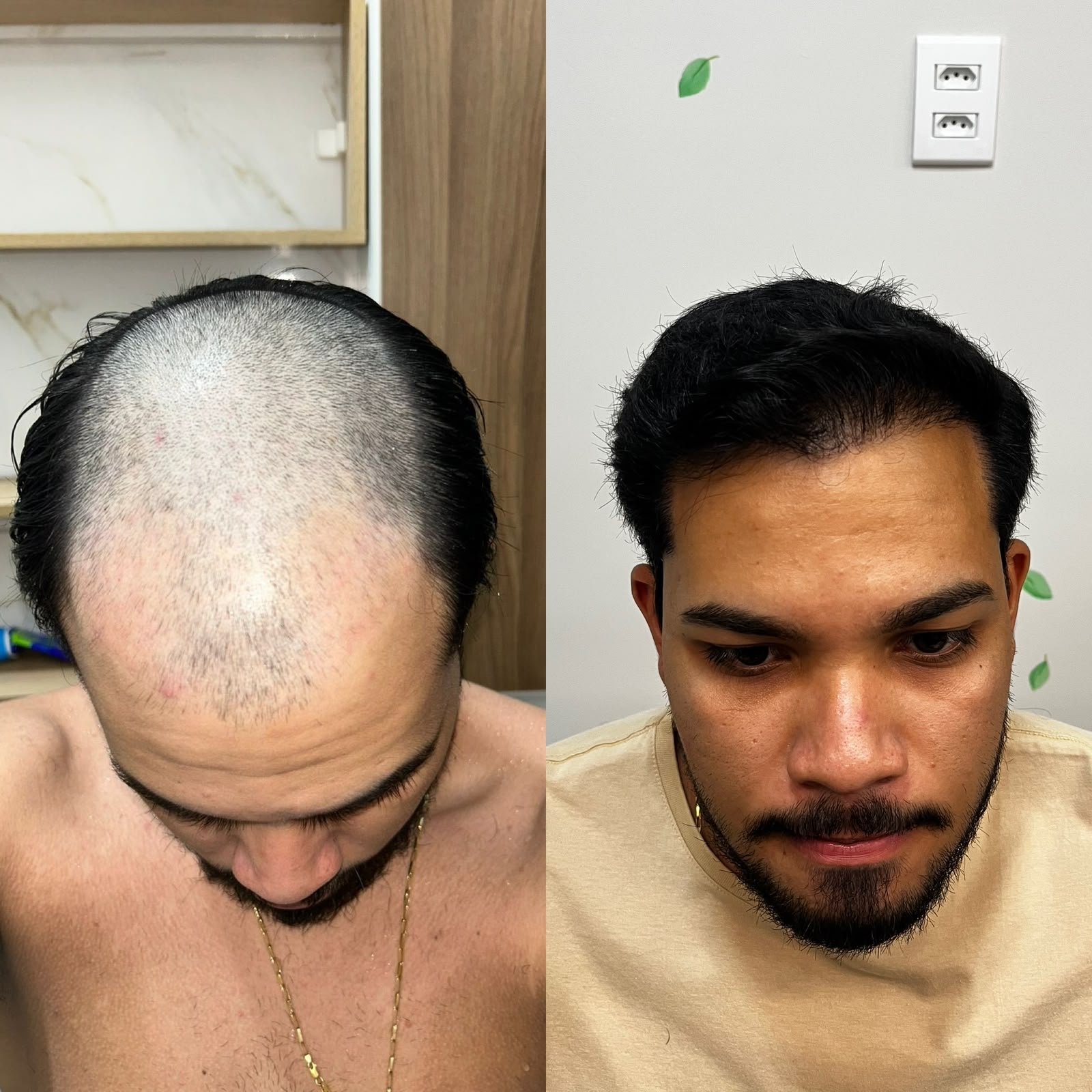 Resultado antes e depois